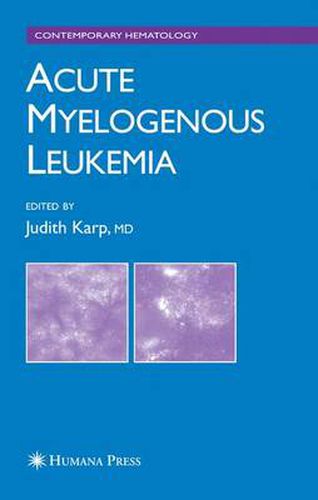 Cover image for Acute Myelogenous Leukemia