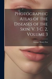 Cover image for Photographic Atlas of the Diseases of the Skin. V. 3 C. 2, Volume 3