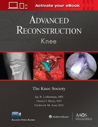 Cover image for Advanced Reconstruction: Knee: Print + Ebook with Multimedia
