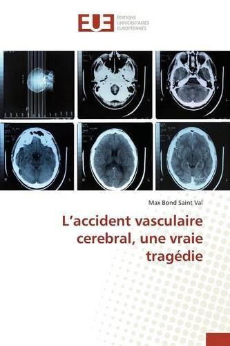 Cover image for L'Accident Vasculaire Cerebral, Une Vraie Tragedie