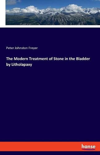 The Modern Treatment of Stone in the Bladder by Litholapaxy