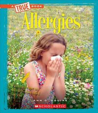 Cover image for Allergies