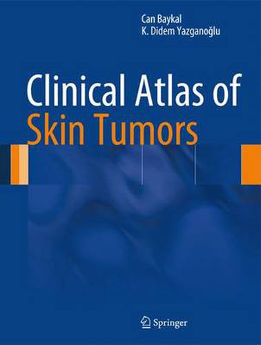 Cover image for Clinical Atlas of Skin Tumors