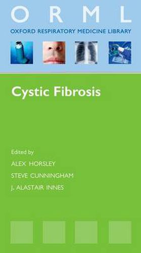 Cover image for Cystic Fibrosis