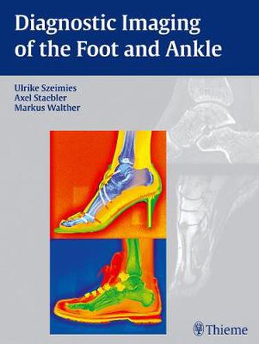 Cover image for Diagnostic Imaging of the Foot and Ankle