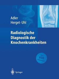 Cover image for Radiologische Diagnostik Der Knochenkrankheiten