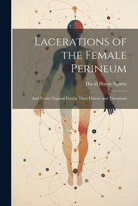 Cover image for Lacerations of the Female Perineum