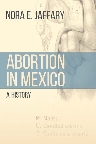 Cover image for Abortion in Mexico