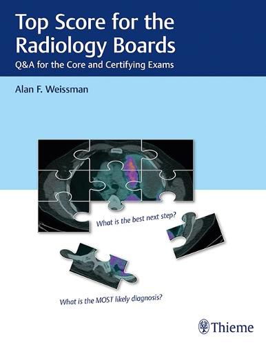 Cover image for Top Score for the Radiology Boards: Q&A for the Core and Certifying Exams