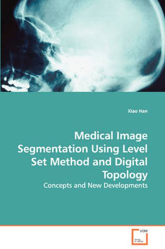 Cover image for Medical Image Segmentation Using Level Set Method and Digital Topology - Concepts and New Developments