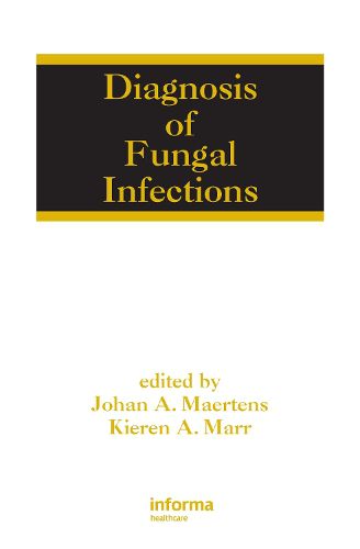 Cover image for Diagnosis of Fungal Infections
