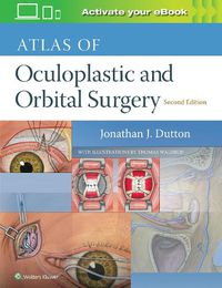 Cover image for Atlas of Oculoplastic and Orbital Surgery