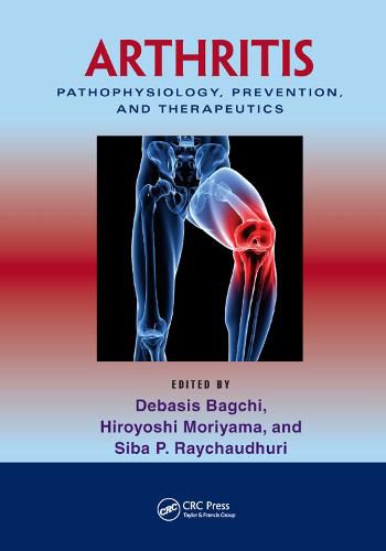 Arthritis: Pathophysiology, Prevention, and Therapeutics