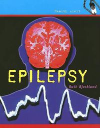 Cover image for Epilepsy