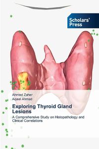 Cover image for Exploring Thyroid Gland Lesions