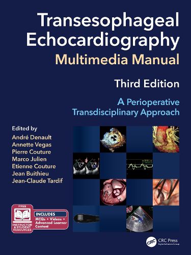 Cover image for Transesophageal Echocardiography Multimedia Manual