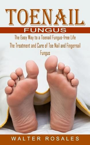 Cover image for Toenail Fungus: The Easy Way to a Toenail Fungus-free Life (The Treatment and Cure of Toe Nail and Fingernail Fungus)