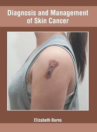 Cover image for Diagnosis and Management of Skin Cancer