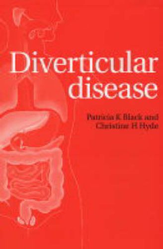 Cover image for Diverticular Disease