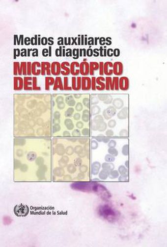 Cover image for Medios Auxiliares Para El Diagnostico Microscopico del Paludismo