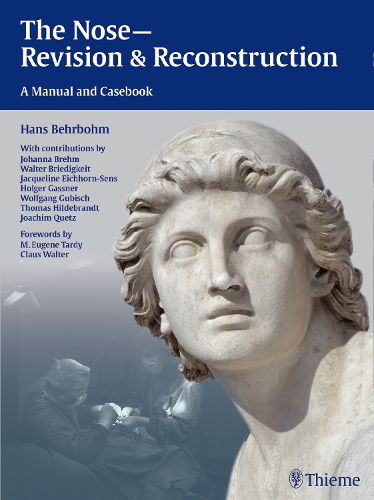 Cover image for The Nose - Revision and Reconstruction: A Manual and Casebook