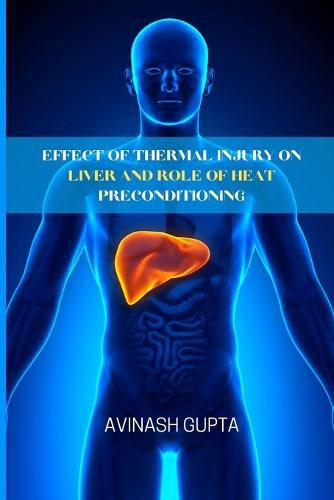 Cover image for Effect of thermal injury on liver and role of heat preconditioning