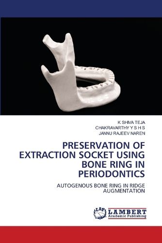 Cover image for Preservation of Extraction Socket Using Bone Ring in Periodontics