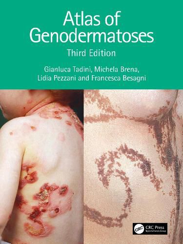 Cover image for Atlas of Genodermatoses