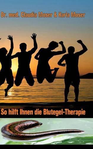 Cover image for So hilft ihnen die Blutegeltherapie