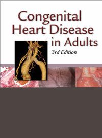 Cover image for Congenital Heart Disease in Adults