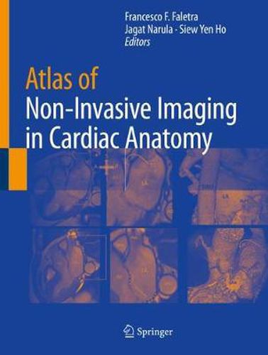 Cover image for Atlas of Non-Invasive Imaging in Cardiac Anatomy