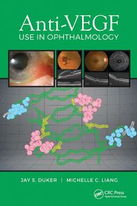 Cover image for Anti-VEGF Use in Ophthalmology