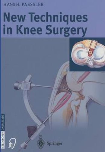 Cover image for New Techniques in Knee Surgery