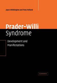 Cover image for Prader-Willi Syndrome: Development and Manifestations