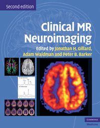Cover image for Clinical MR Neuroimaging: Physiological and Functional Techniques