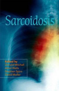 Cover image for Sarcoidosis