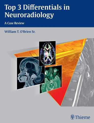 Cover image for Top 3 Differentials in Neuroradiology