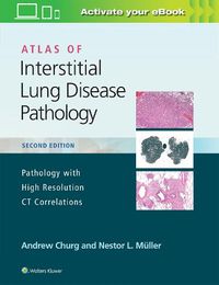 Cover image for Atlas of Interstitial Lung Disease Pathology