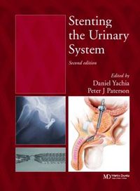 Cover image for Stenting the Urinary System