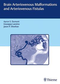 Cover image for Brain Arteriovenous Malformations and Arteriovenous Fistulas