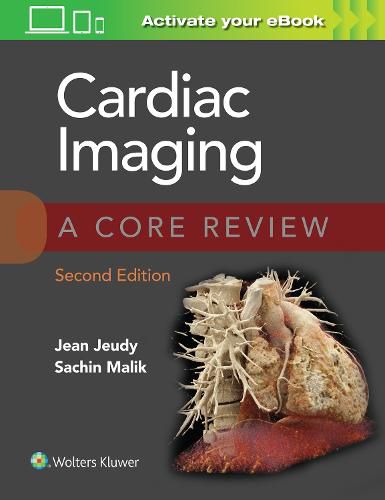 Cover image for Cardiac Imaging: A Core Review