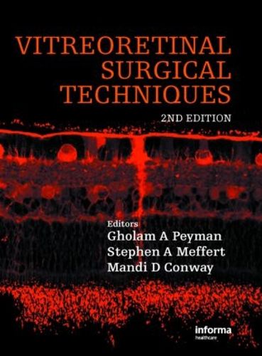 Cover image for Vitreoretinal Surgical Techniques