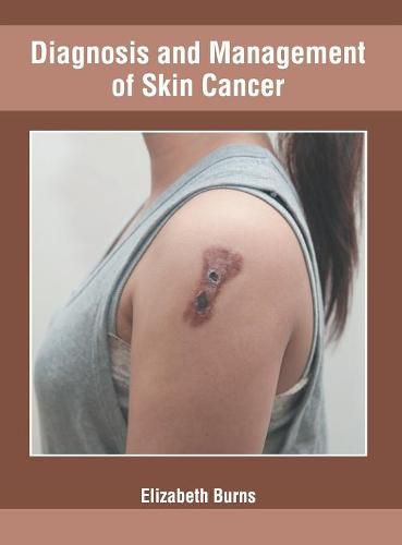 Diagnosis and Management of Skin Cancer