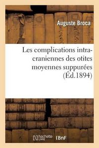 Cover image for Les Complications Intra-Craniennes Des Otites Moyennes Suppurees