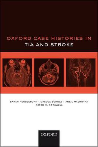 Cover image for Oxford Case Histories in TIA and Stroke