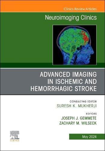 Advanced Imaging in Ischemic and Hemorrhagic Stroke, An Issue of Neuroimaging Clinics of North America: Volume 34-2