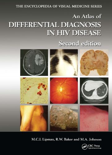 Cover image for An Atlas of Differential Diagnosis in HIV Disease