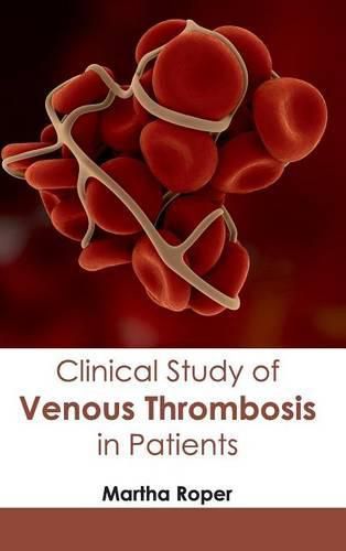 Cover image for Clinical Study of Venous Thrombosis in Patients