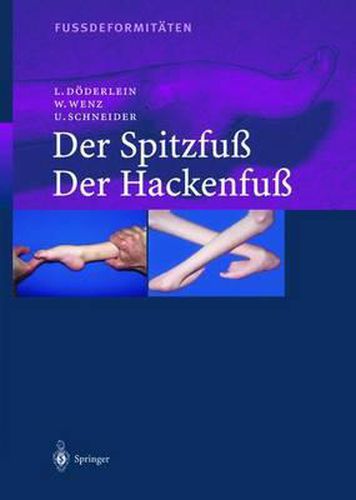 Cover image for Fussdeformitaten: Der Spitzfuss/Der Hackenfuss