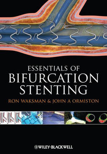 Cover image for Bifurcation Stenting